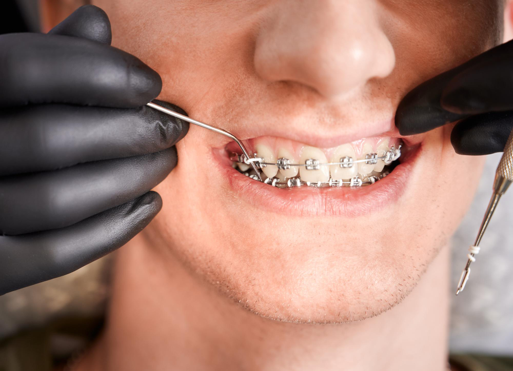 New orthodontic patients welcome at Schur Orthodontics in Bellevue, WA