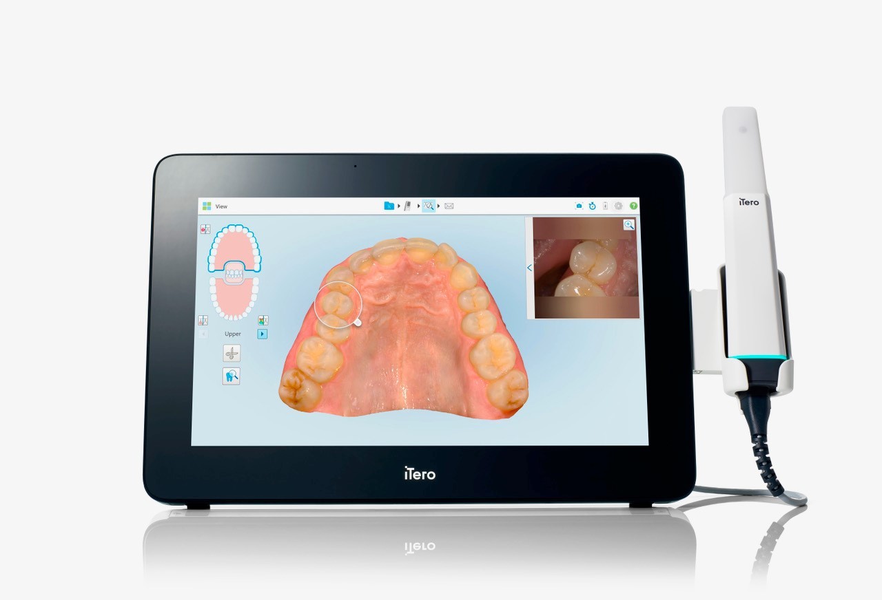 iTero Digital Scanner