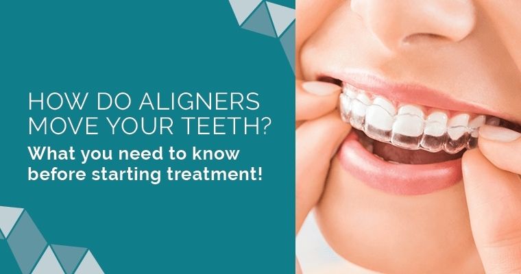 How Do Clear Aligners Straighten Teeth? (Read This Before Treatment)