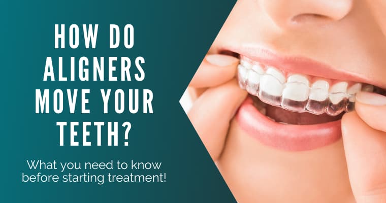 How Do Clear Aligners Straighten Teeth Read This Before Treatment